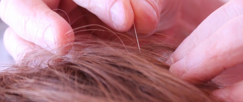What is Acupuncture Medicine?